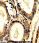 CCL4 Antibody (Center)